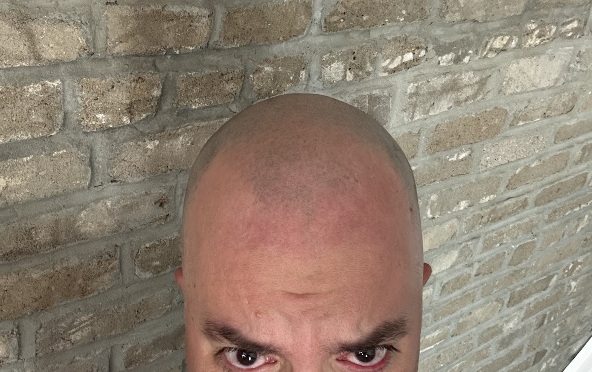 I Shaved My Head